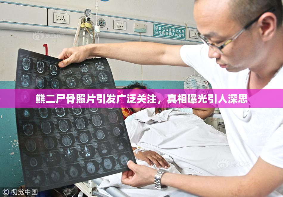 熊二尸骨照片引发广泛关注，真相曝光引人深思