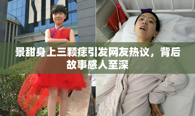 景甜身上三颗痣引发网友热议，背后故事感人至深