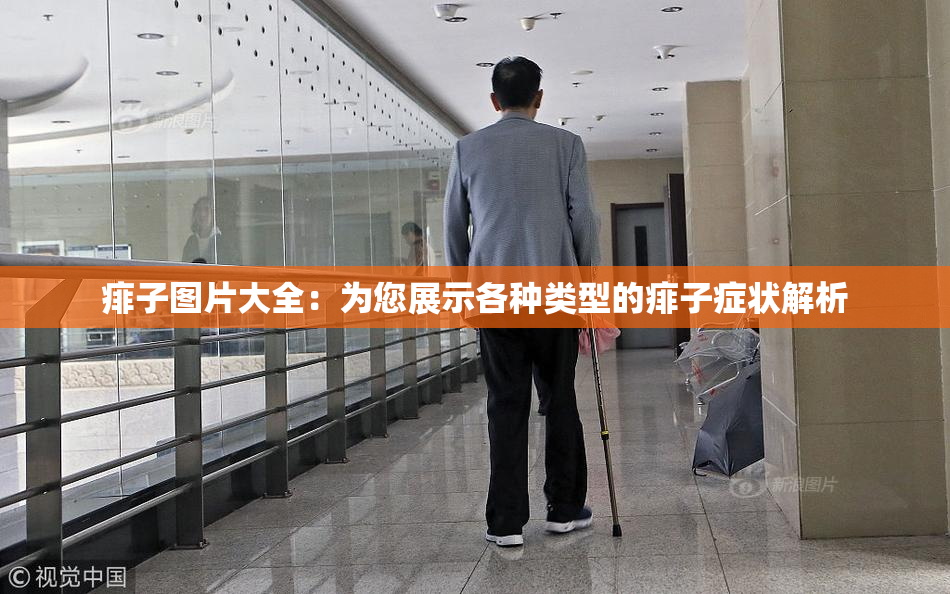 痱子图片大全：为您展示各种类型的痱子症状解析