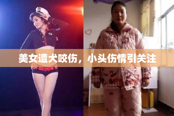 美女遭犬咬伤，小头伤情引关注