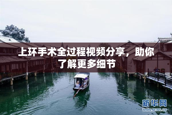 上环手术全过程视频分享，助你了解更多细节