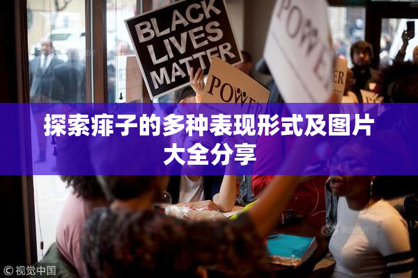 探索痱子的多种表现形式及图片大全分享