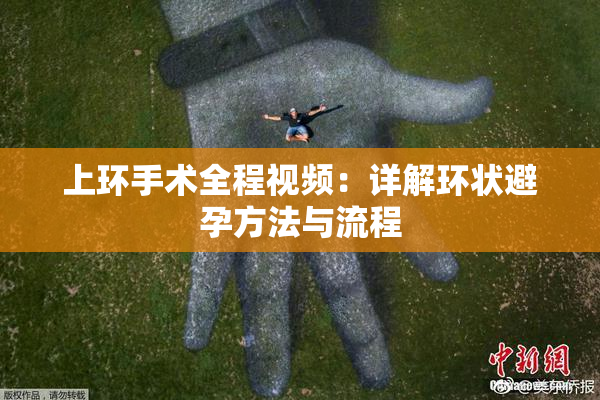 上环手术全程视频：详解环状避孕方法与流程