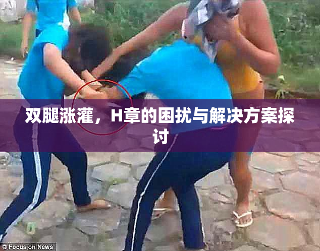 双腿涨灌，H章的困扰与解决方案探讨