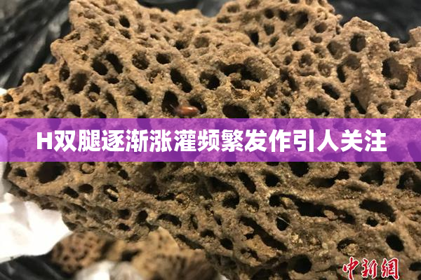 H双腿逐渐涨灌频繁发作引人关注