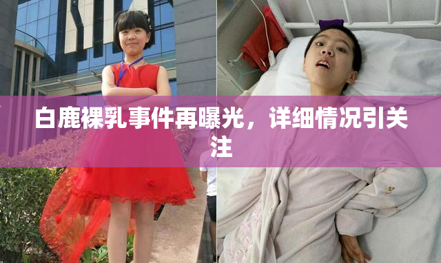 白鹿裸乳事件再曝光，详细情况引关注