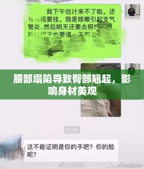 腰部塌陷导致臀部翘起，影响身材美观