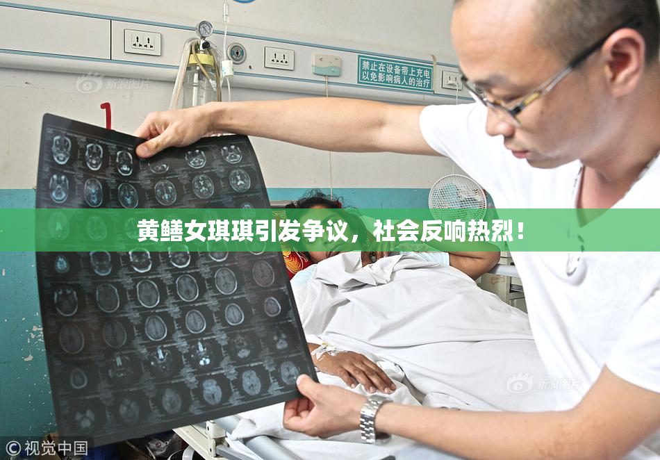 黄鳝女琪琪引发争议，社会反响热烈！