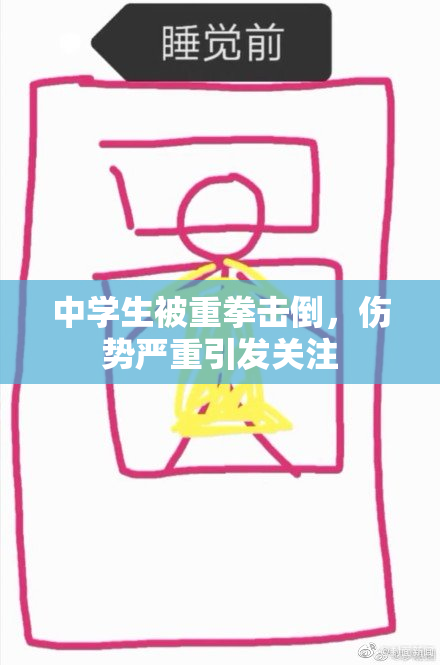 中学生被重拳击倒，伤势严重引发关注