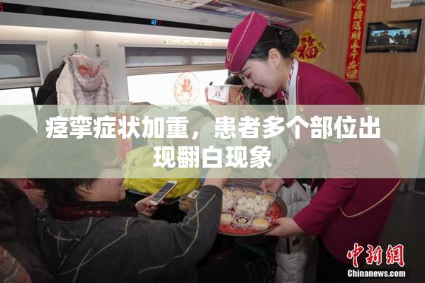 痉挛症状加重，患者多个部位出现翻白现象